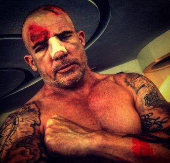 Dominic Purcell Suffered A Broken Nose While Filming Prison Break In Morocco