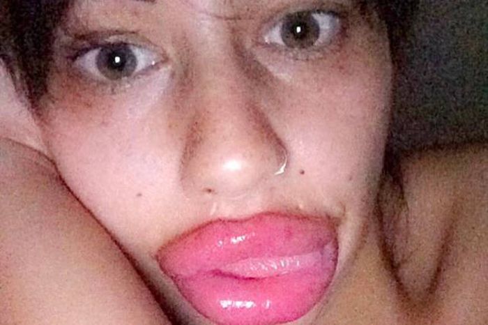 This Woman Wants To Take Her Huge Lips And Make Them Even Bigger