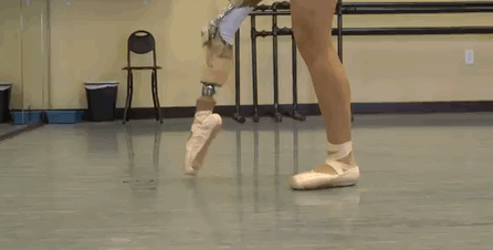 Teenage Amputee Ballerina Makes An Incredible Recovery