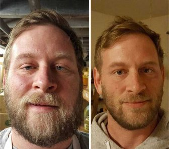 Heavy Drinkers Go Through Impressive Transformations After Giving Up Alcohol