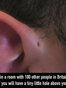 The Reason Why Some People Have Little Holes Above Their Ears