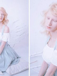 You'll Be Amazed By These Albino People And Their Unique Beauty