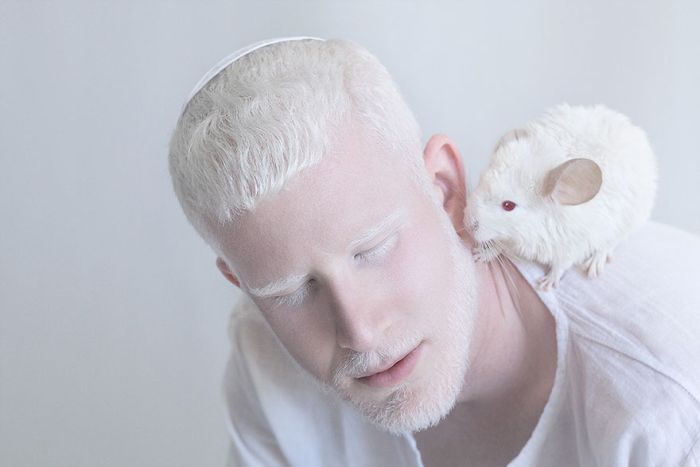You'll Be Amazed By These Albino People And Their Unique Beauty