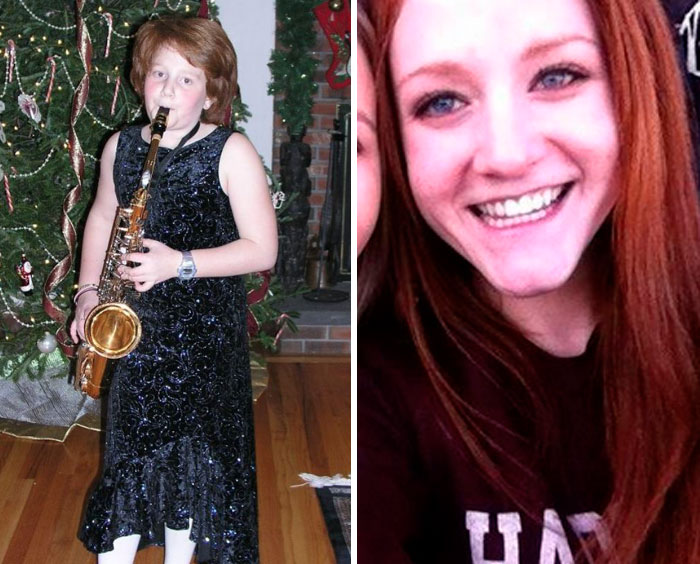 People Share Their Unbelievable Ugly Duckling Transformations
