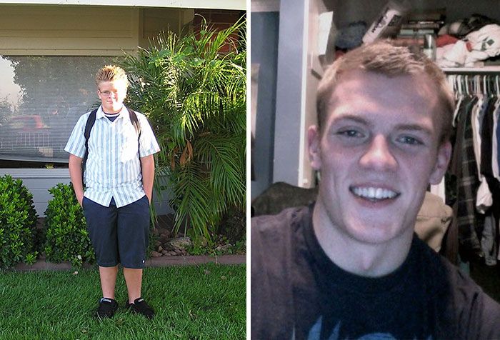 People Share Their Unbelievable Ugly Duckling Transformations