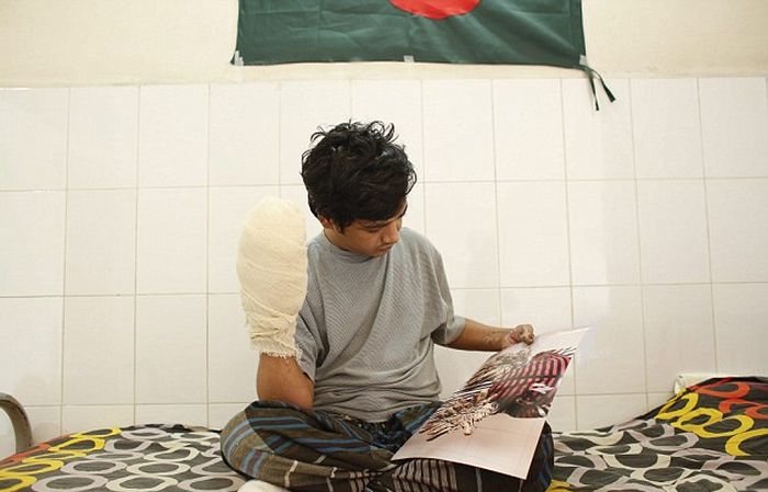 Bangladesh Man With Rare Disease Finally Cured