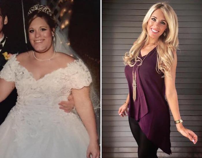 Embarrassed Mom Undergoes Incredible Weight Loss Transformation