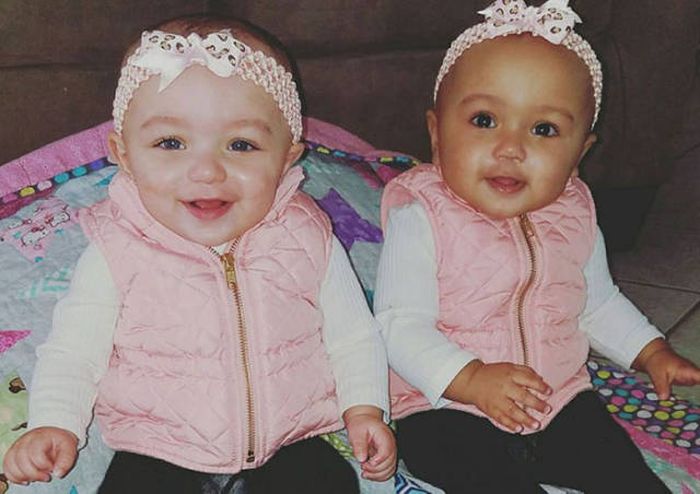 These Adorable Twin Sisters Have Defied The Laws Of Nature