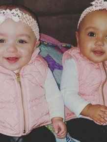 These Adorable Twin Sisters Have Defied The Laws Of Nature