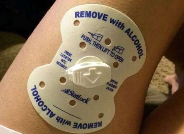 How To Remove With Alcohol