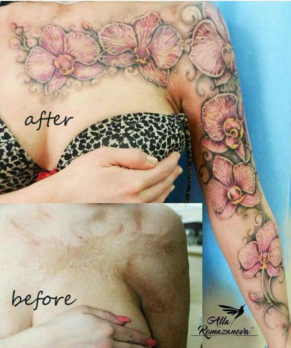 Beautiful Girl Uses Tattoos To Cover Up Her Scars