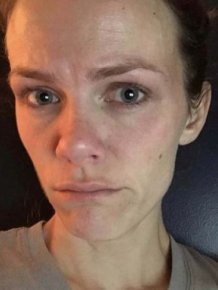 Brooklyn Decker With And Without Makeup