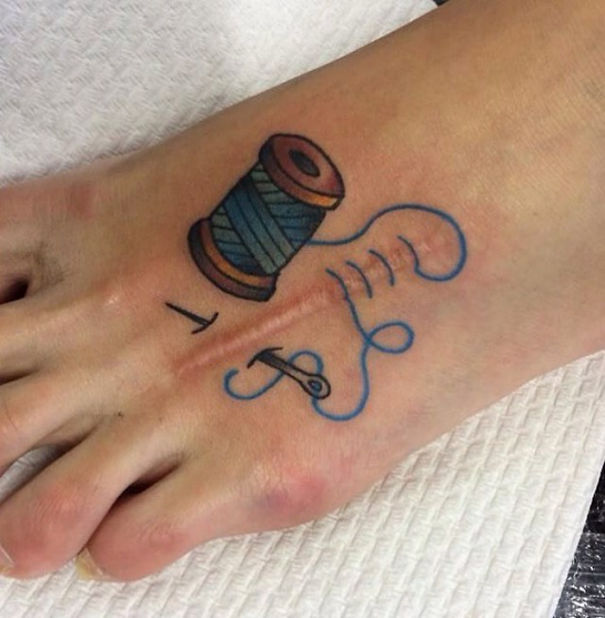 Tattoos Can Turn Scars Into Works Of Art