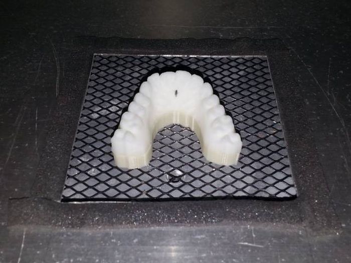 Student Proves You Don't Need Thousands Of Dollars To Fix Your Teeth