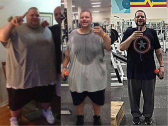 Amazing Weight Loss: Before and After