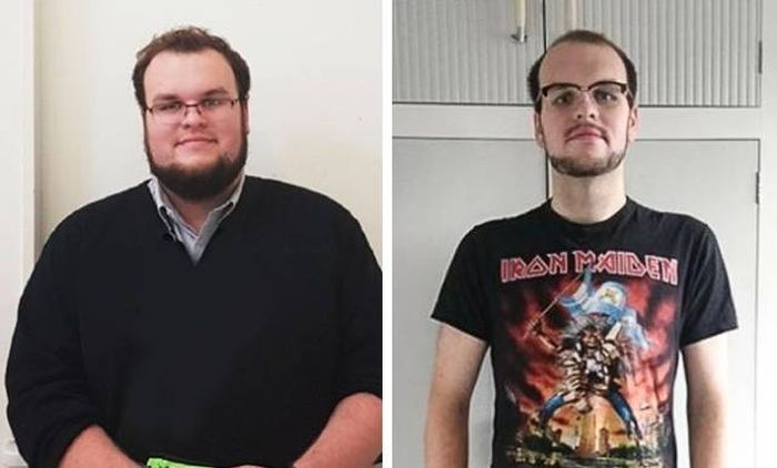 Before And After Losing Weight