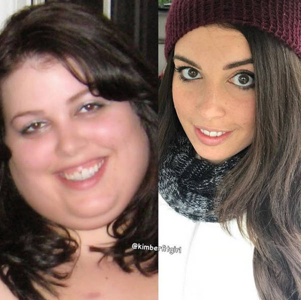 Before And After Losing Weight