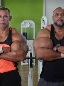 Brazilian Brothers Inject Themselves With Dangerous Chemicals To Create Biceps
