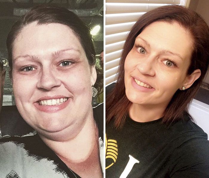 A Woman Lost 150 Pounds