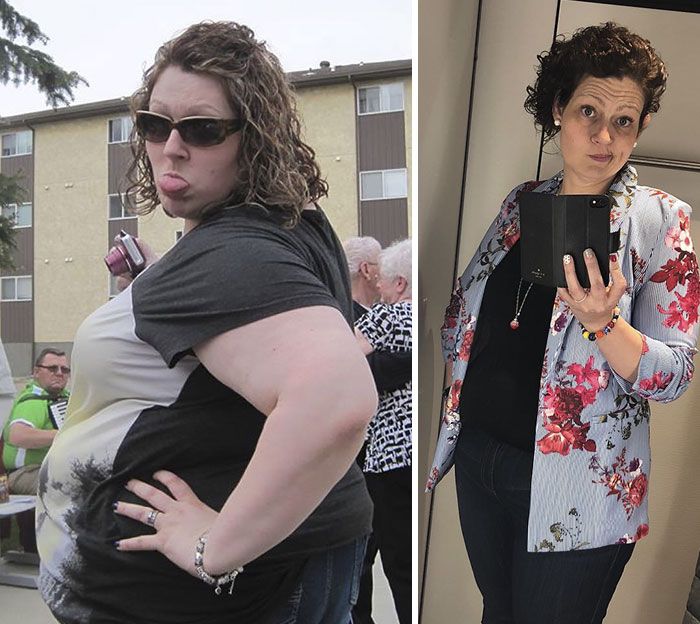 A Woman Lost 150 Pounds