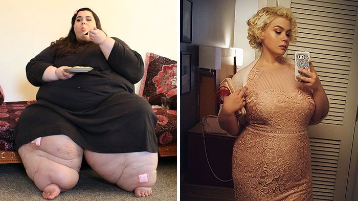Unbelievable Before & After Transformation Photos