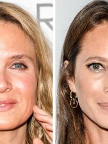How Plastic Surgery Affect Celebs Who Were Actually Born In The Same Year