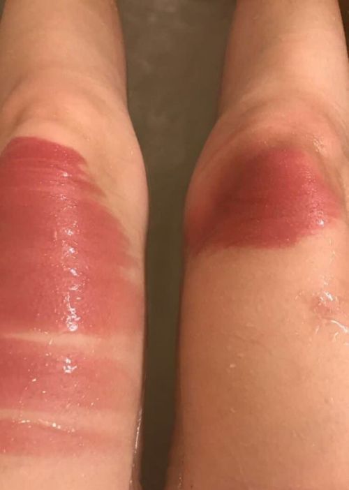 Ripped Jeans In The Sun Are Very Bad For Your Skin