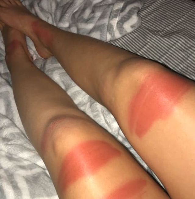 Ripped Jeans In The Sun Are Very Bad For Your Skin