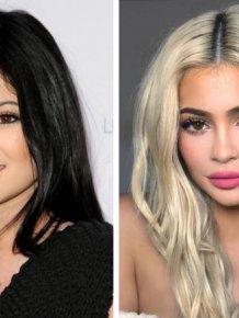 Celebrities Before Plastic Surgery