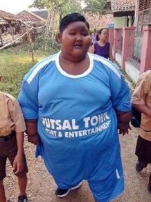 Indonesia’s Fattest Kid Lost Half His Body Weight