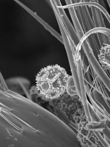 Pollen On A Bee, Seen Through A Powerful Microscope