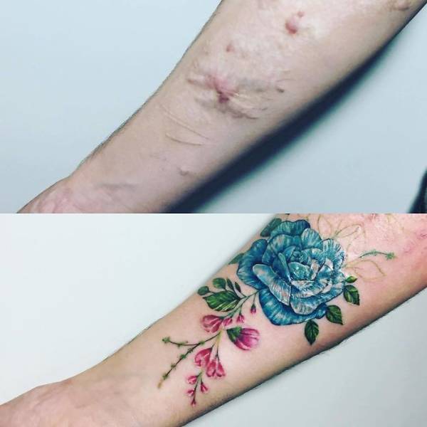 How To Cover A Scar With Tattoo