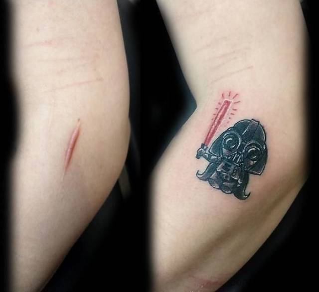 How To Cover A Scar With Tattoo