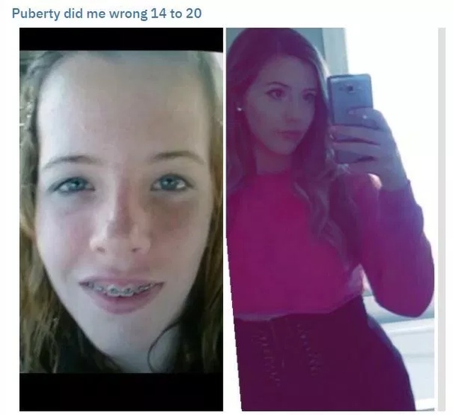 Teenager Transformations