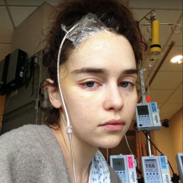 Emilia Clarke Shares Photos From Hospital Treatment During Brain Aneurysm Ordeal