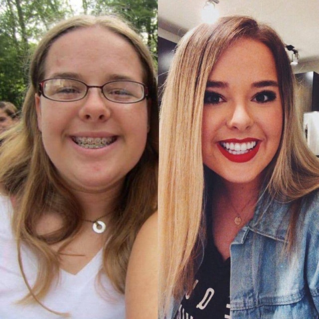 Ugly Ducklings Then And Now, part 2