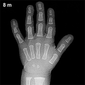Interesting X-Rays And Scans