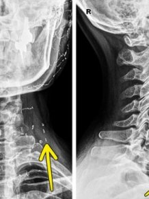 Interesting X-Rays And Scans