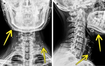 Interesting X-Rays And Scans