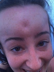 Girl Starts To Look Like An Alien Due To Random Head Swelling