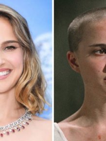 Famous People With And Without Hair