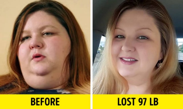 Before & After Weight Loss
