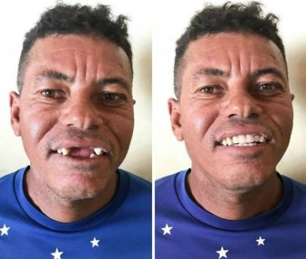 Brazilian Dentist Travels To Treat The Teeth Of Poor People For Free