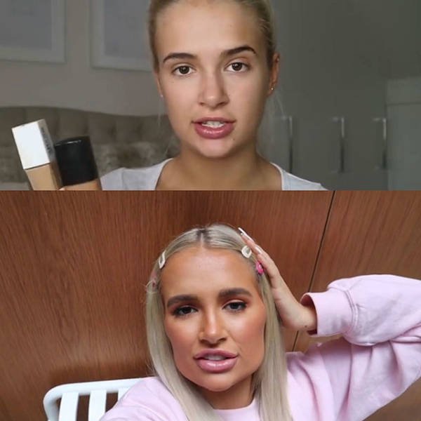 Plastic Surgery Went Wrong