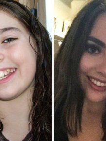 Then And Now: People Fix Their Smiles
