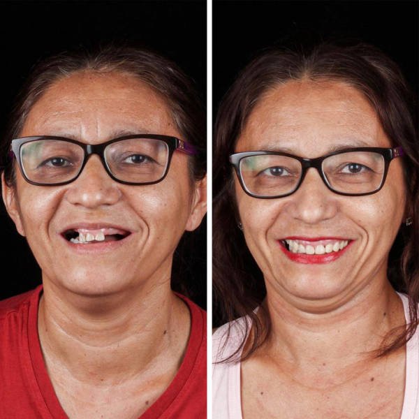 Brazilian Dentist Treats Poor People For Free