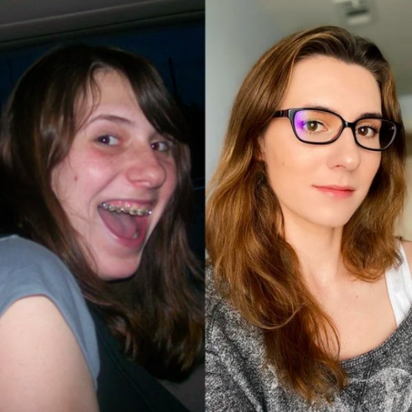 Girls Show Their Dramatic Changes