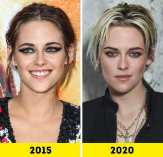 Celebrities Changed A Lot Over The Last Five Years