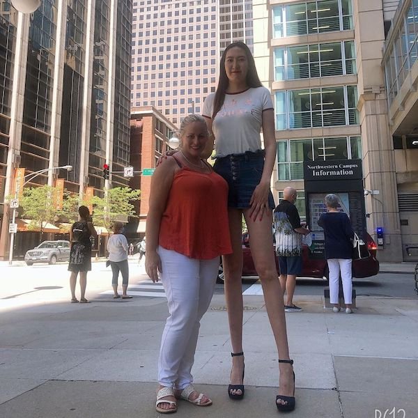 This Girl Has The World's Longest Legs