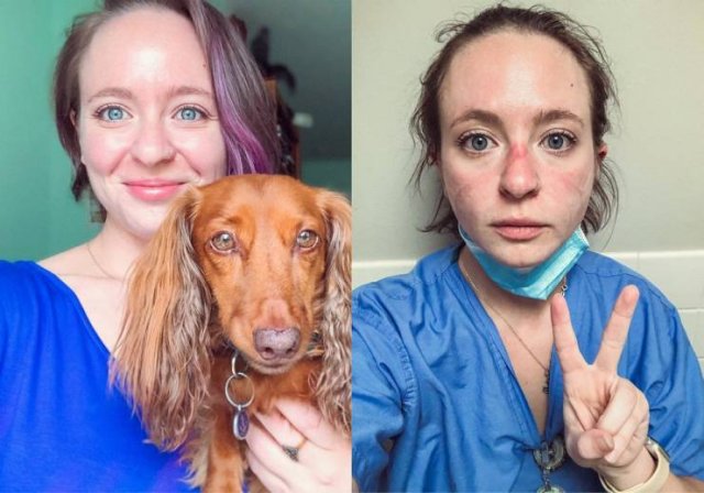 Nurse Shows Her Changes After Nine Months Of Pandemic